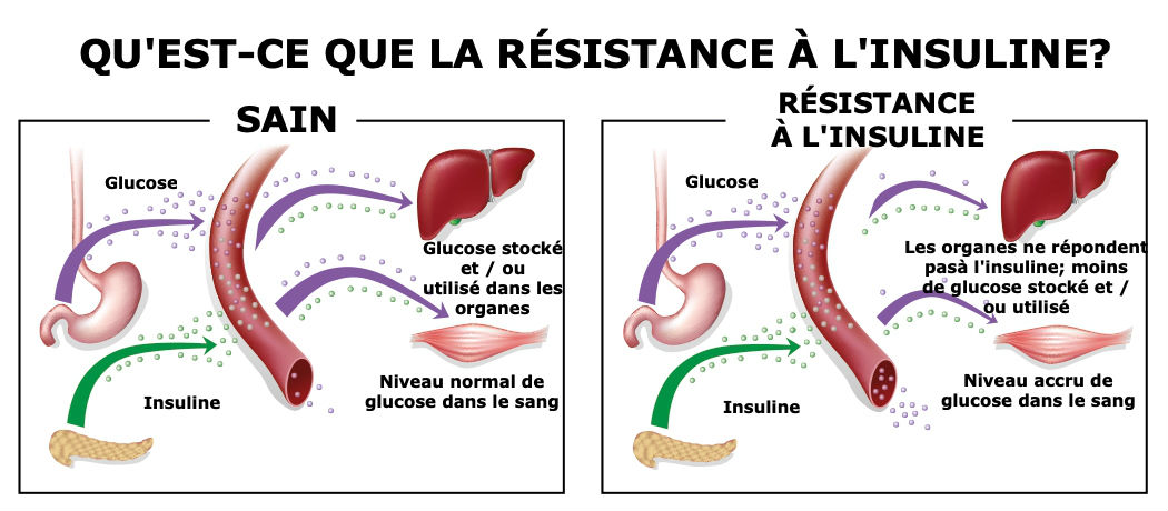 resistance-a-linsuline